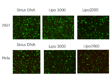 Sirius DNA Transfection Reagent P400025、 P400150